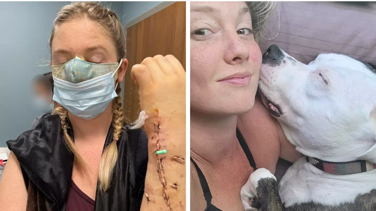 Woman rushed to hospital after boyfriend's dog tore off her nose in brutal attack
