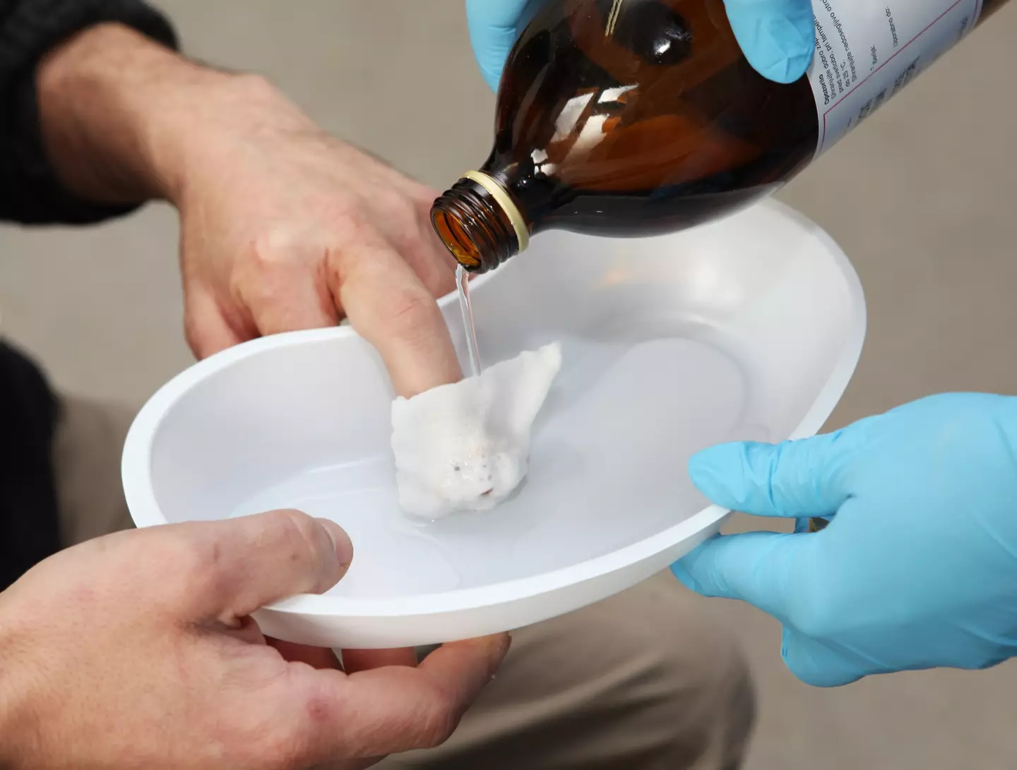 Properly cleaning a wound can prevent sepsis.