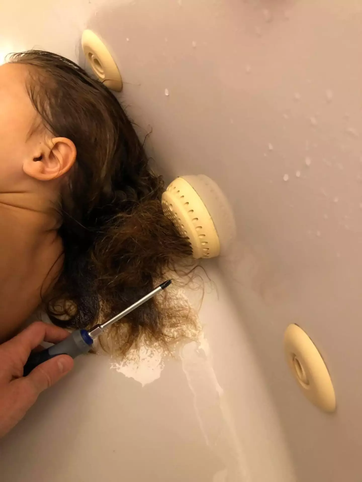 Elizabeth's hair had gotten trapped in a suction valve.