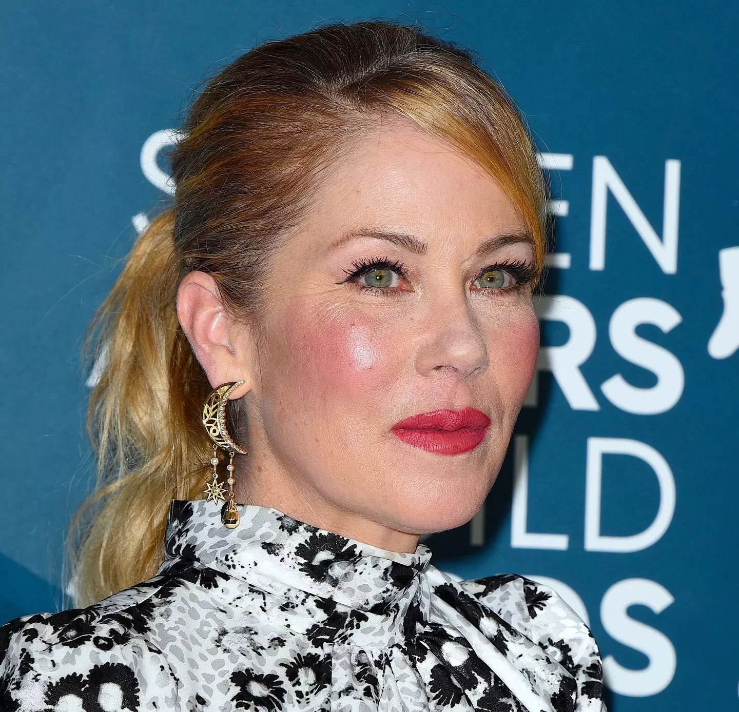 Christina Applegate was first diagnosed with MS in 2021.