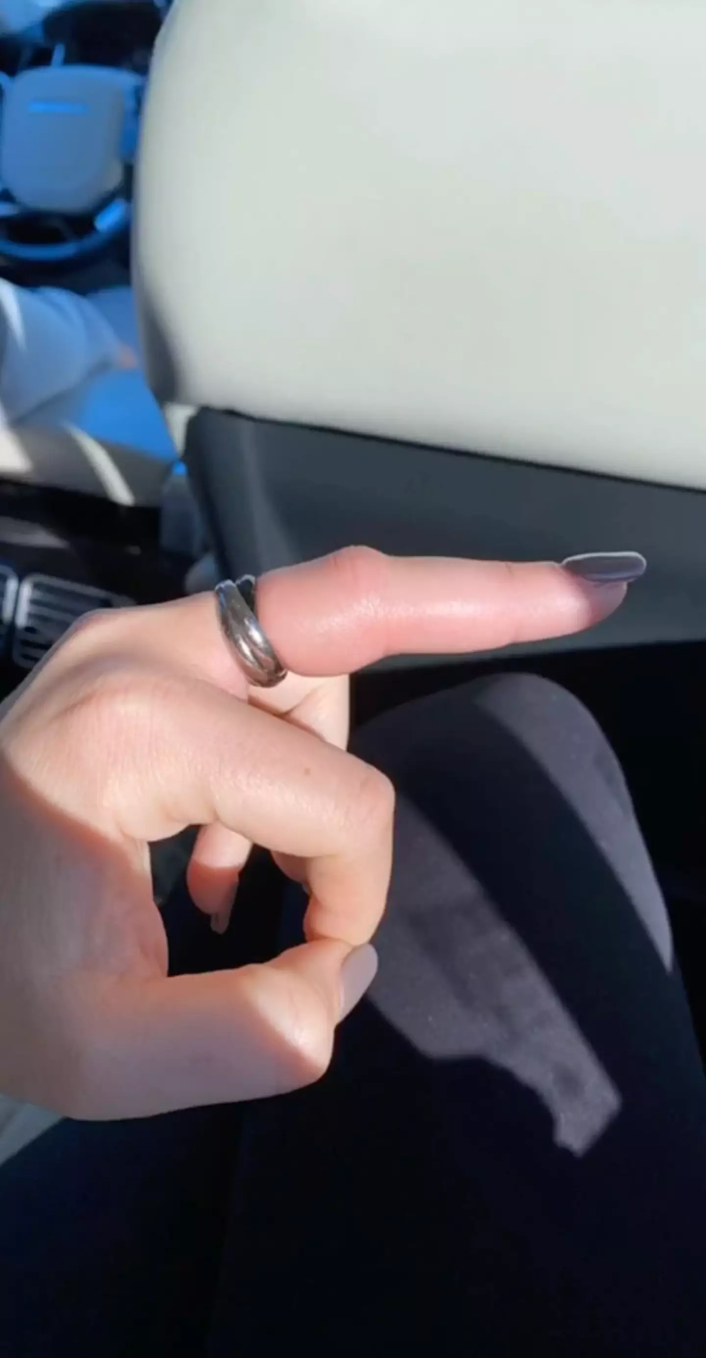 Big yikes.