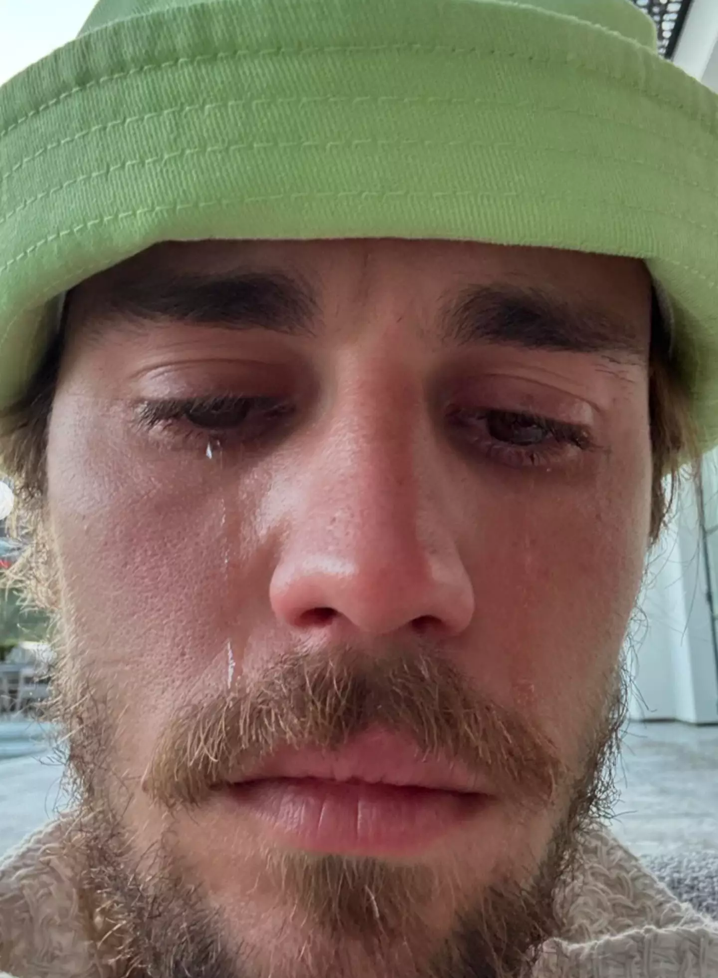 Justin is yet to respond to fans' concern. (Instagram/@justinbieber)