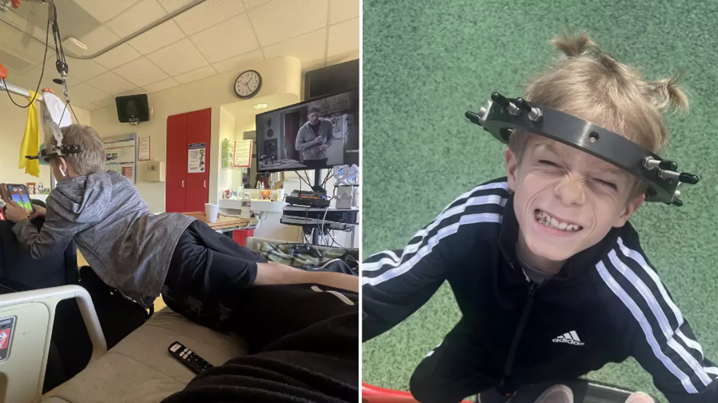 11-year-old boy had to hang in frame for 12 hours a day ahead of spinal surgery