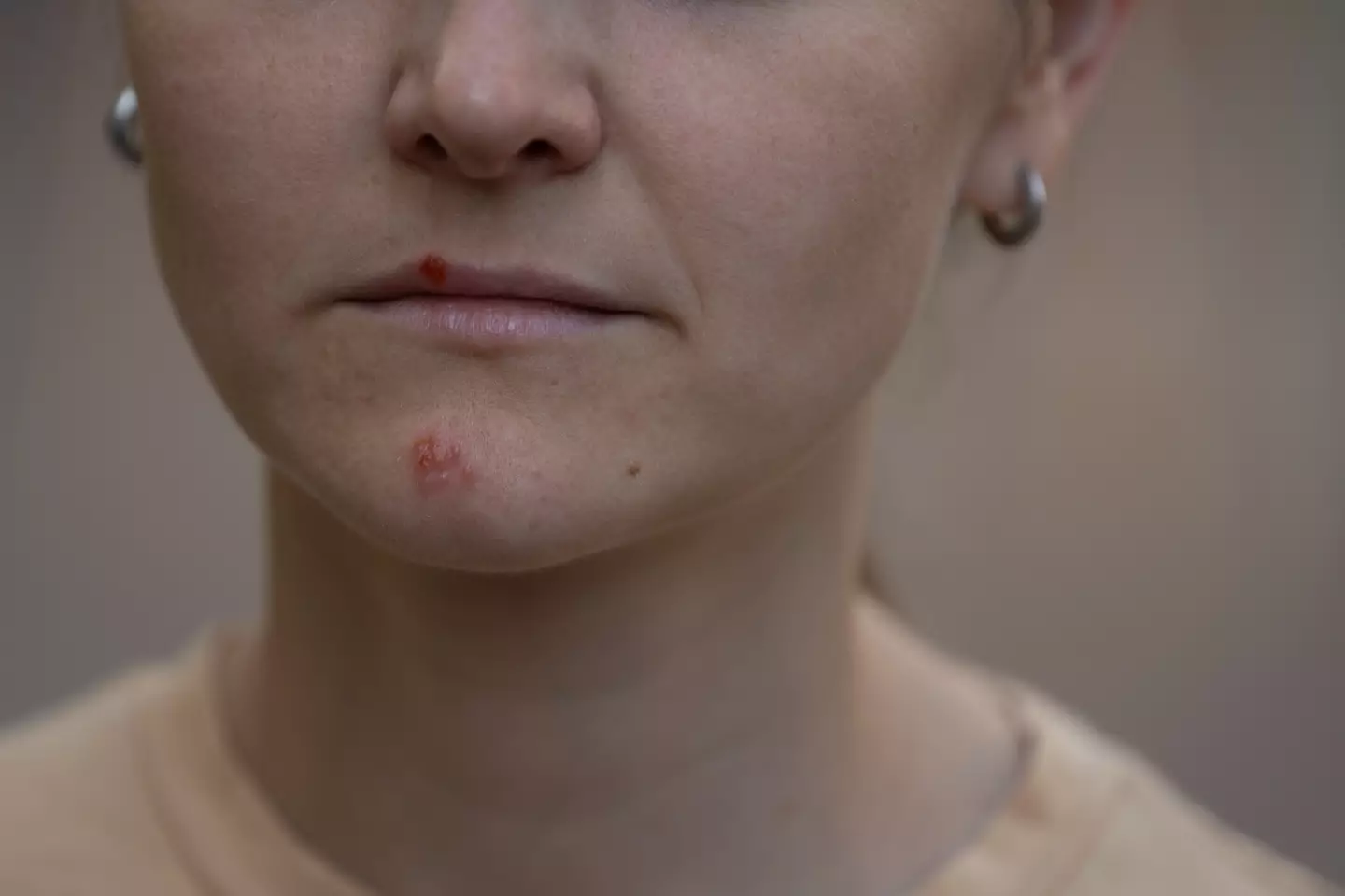 Beards can harbour bacteria which can then be transferred through breaks in the skin, and lead to skin issues like impetigo (Getty stock image)