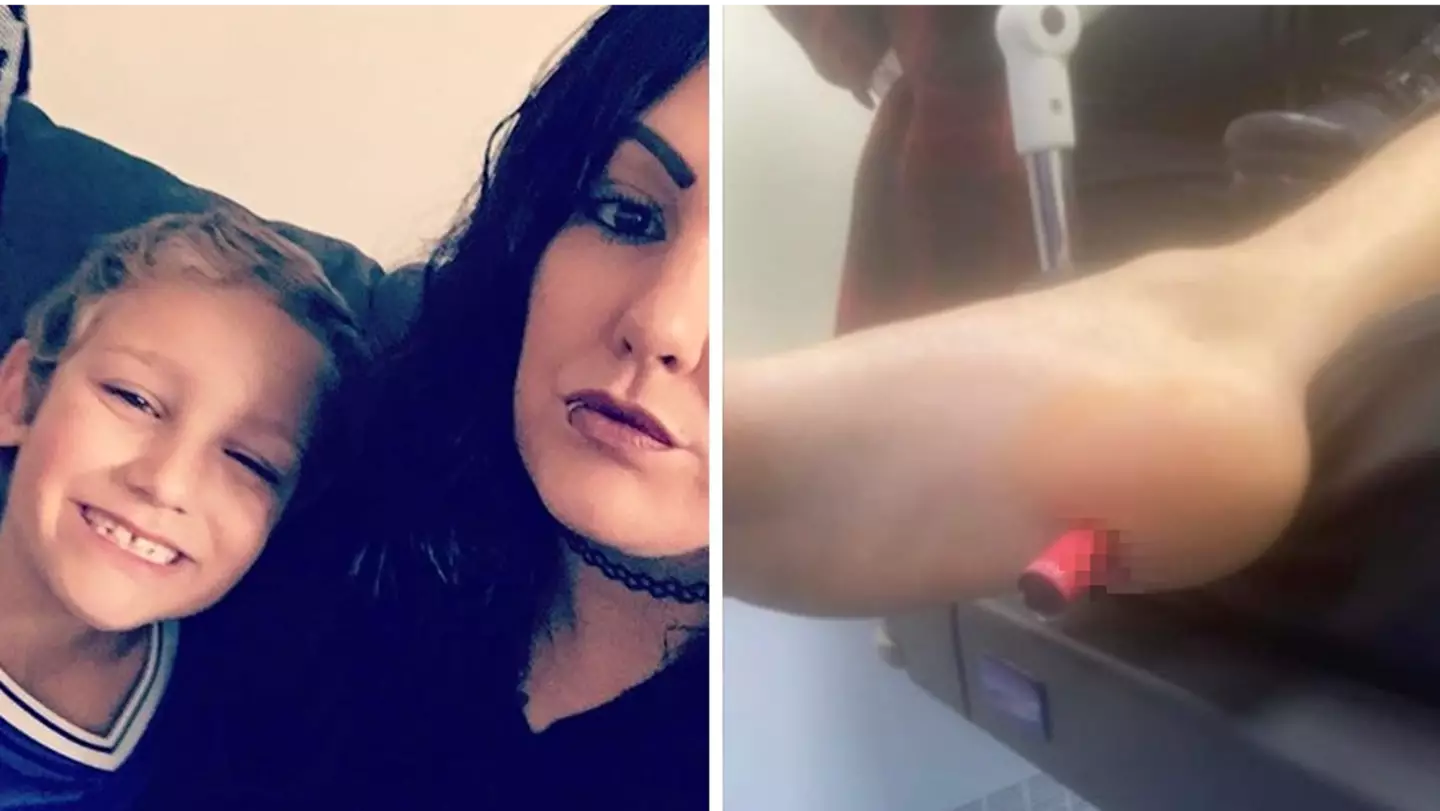 Mum shares warning after son gets vape impaled in his foot
