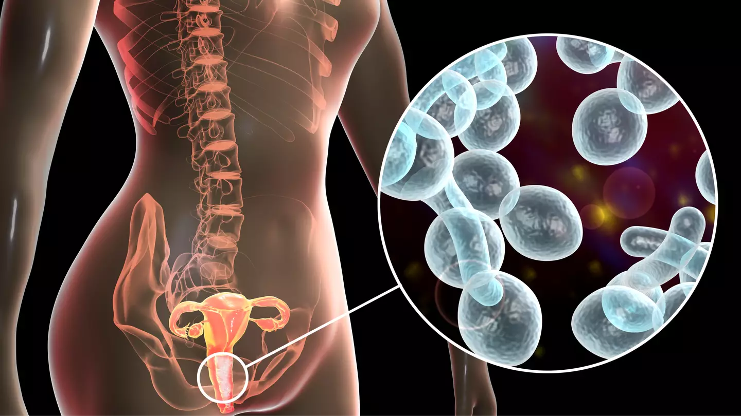 Scientists reveal common infection among women can actually be passed on from men during sex