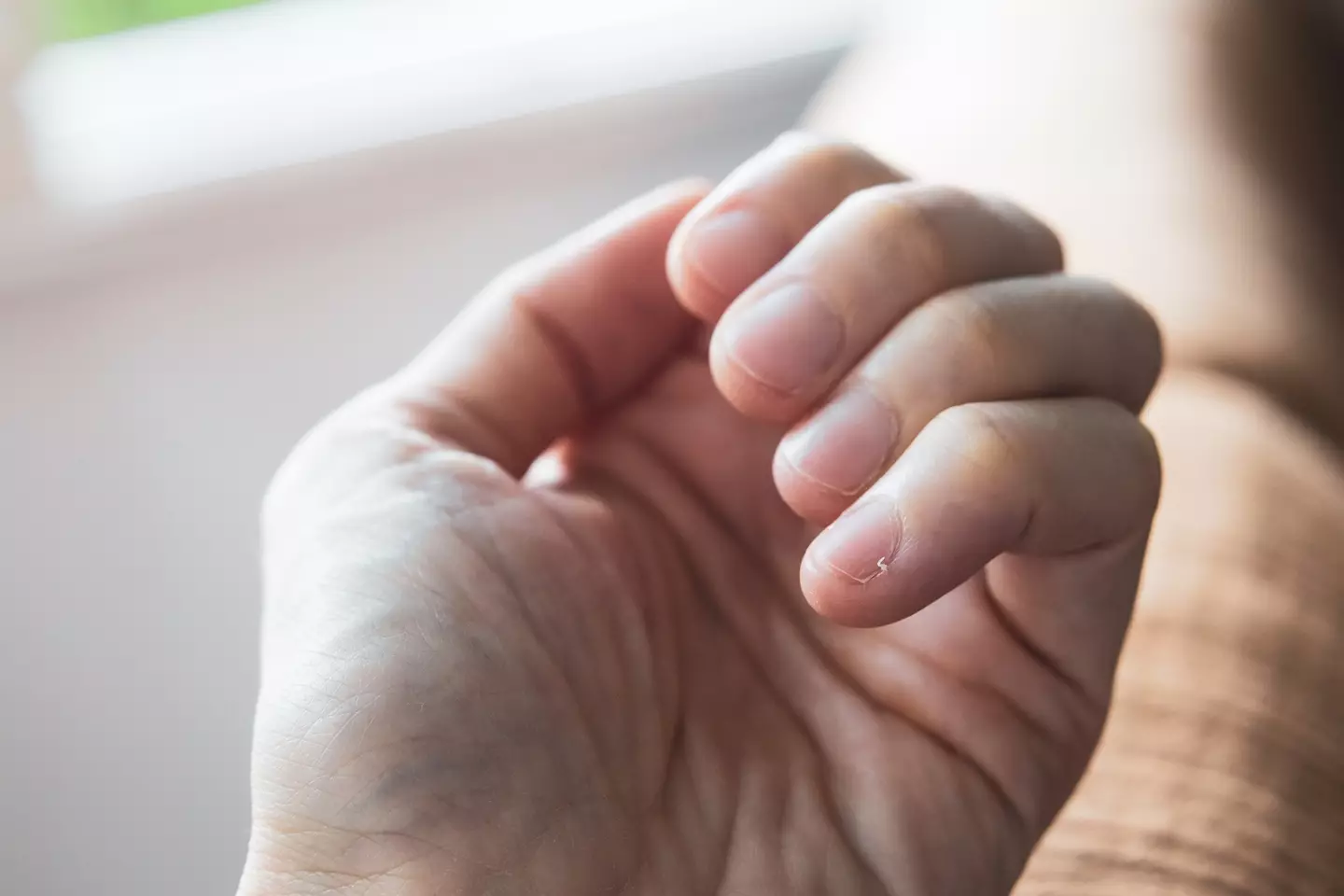 A doctor has revealed the warning sign of a serious illness that can be visible in your hands (Getty Stock Photo)