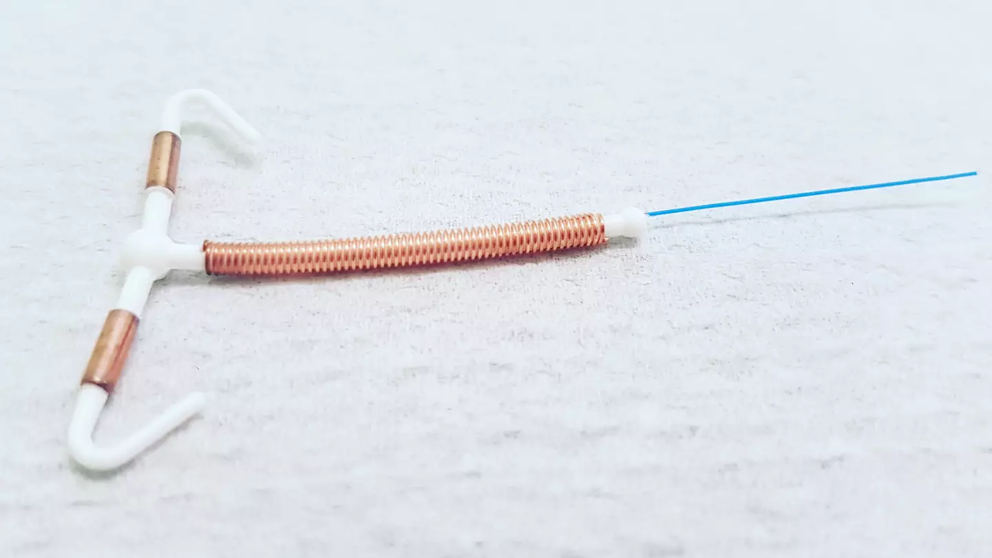 IUD insertions do not require anaesthetic. (