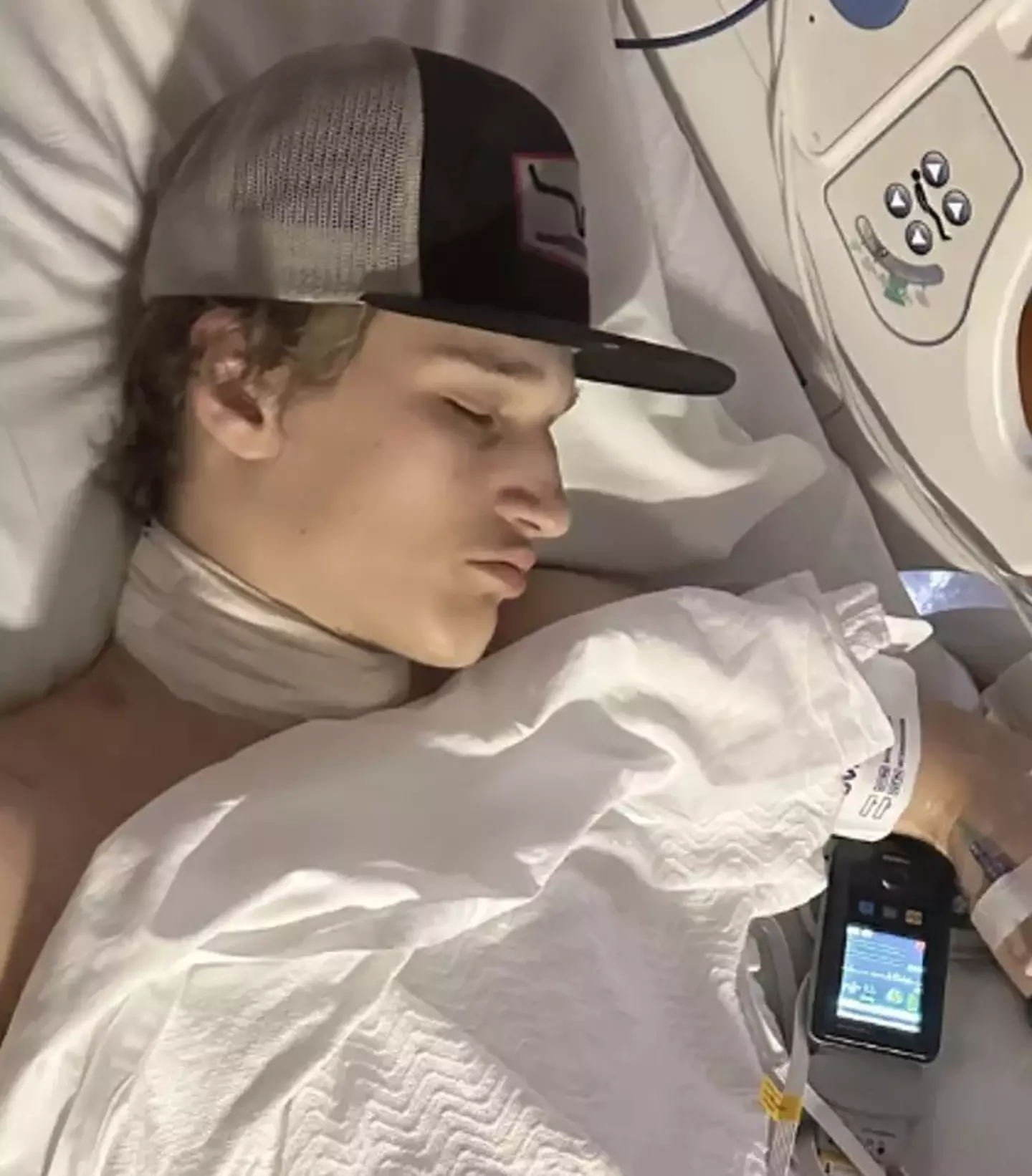 The teen's mum says medical staff are keen for her son to complete a skin graft. (Kennedy News and Media)