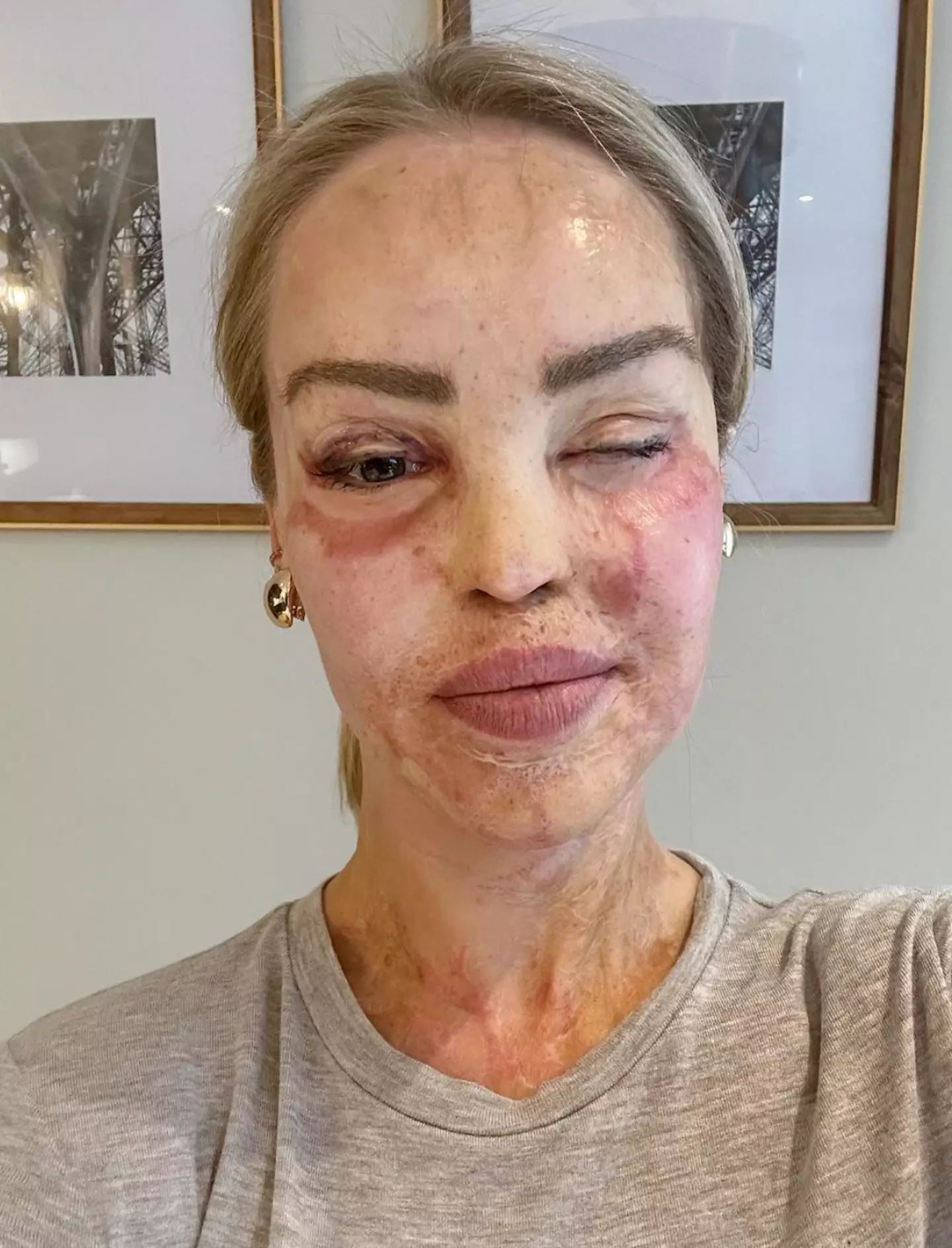 Katie Piper has issued a plea to her 'intelligent' social media followers.