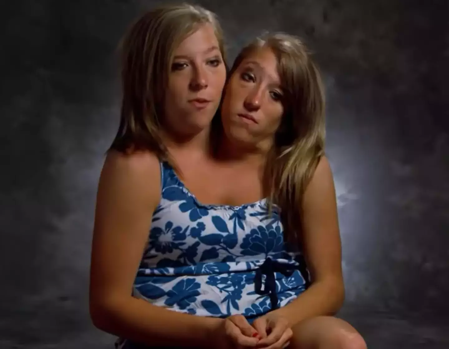 Abby and Brittany Hensel are conjoined twins. (YouTube/OMG Stories)