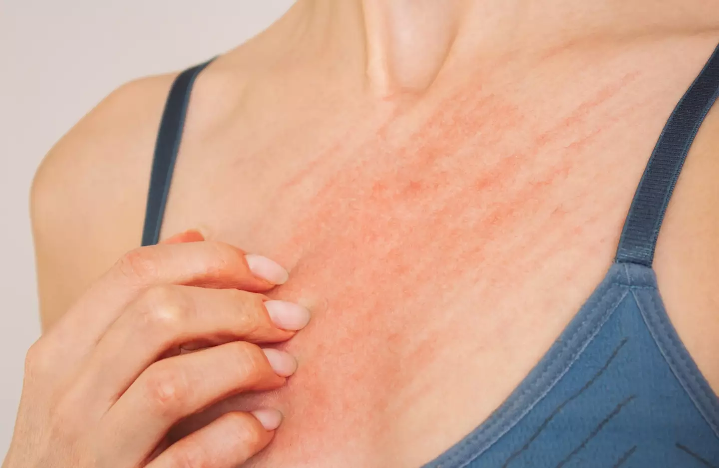 Medical professionals recommend to seek advice as soon as possible (Getty Stock Images)