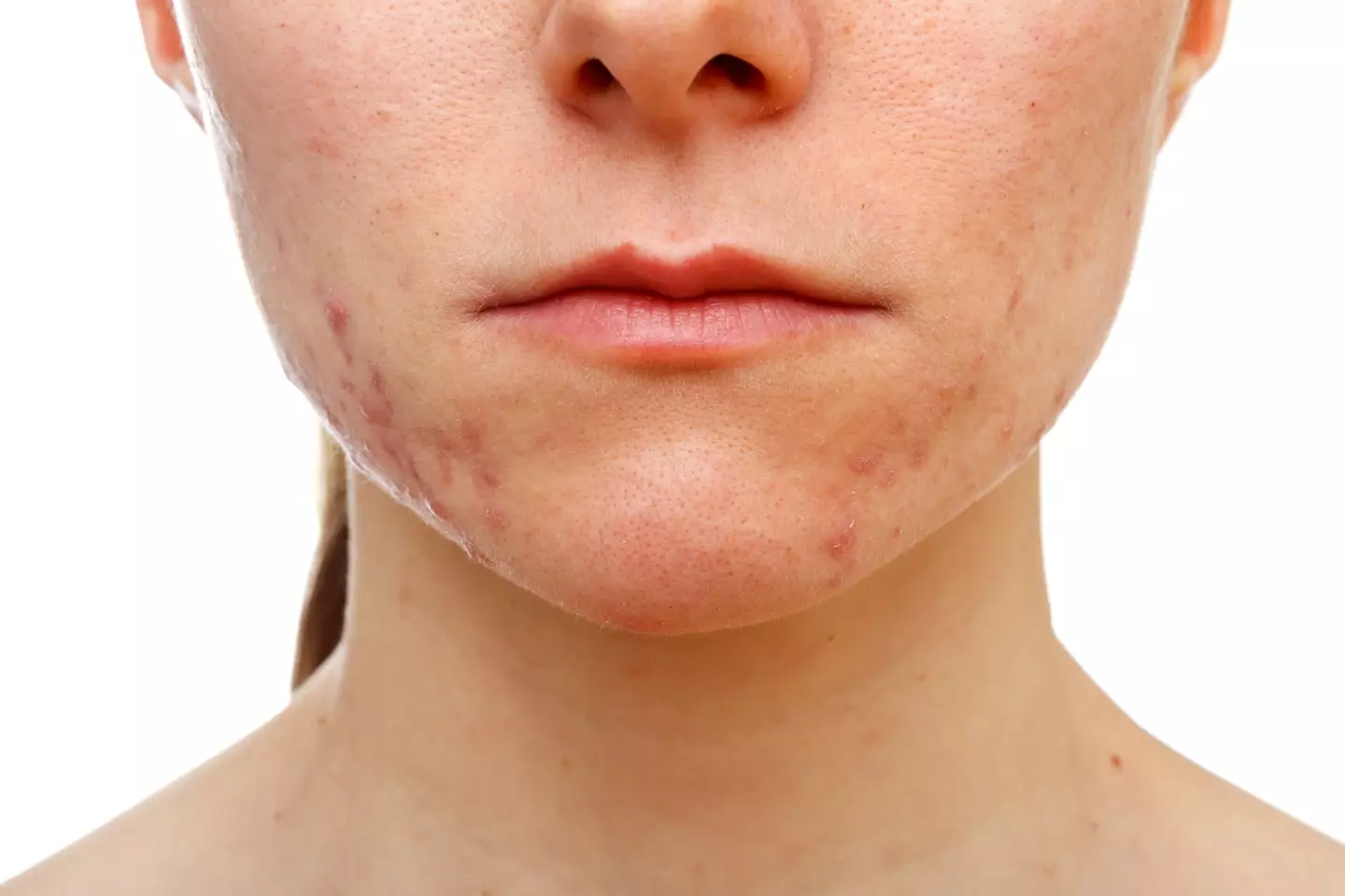 These types of spots differ from those on other areas of the body (Obencem/Getty)