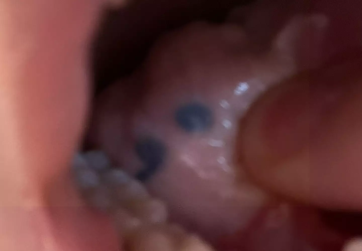 Following her gruelling six-hour surgery, the tattoo is now under her tongue (SWNS)