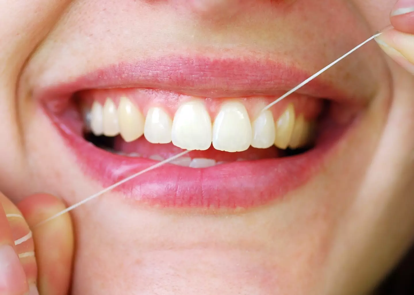 Flossing may help protect against head and neck cancer (AnthonyRosenberg / Getty Images)