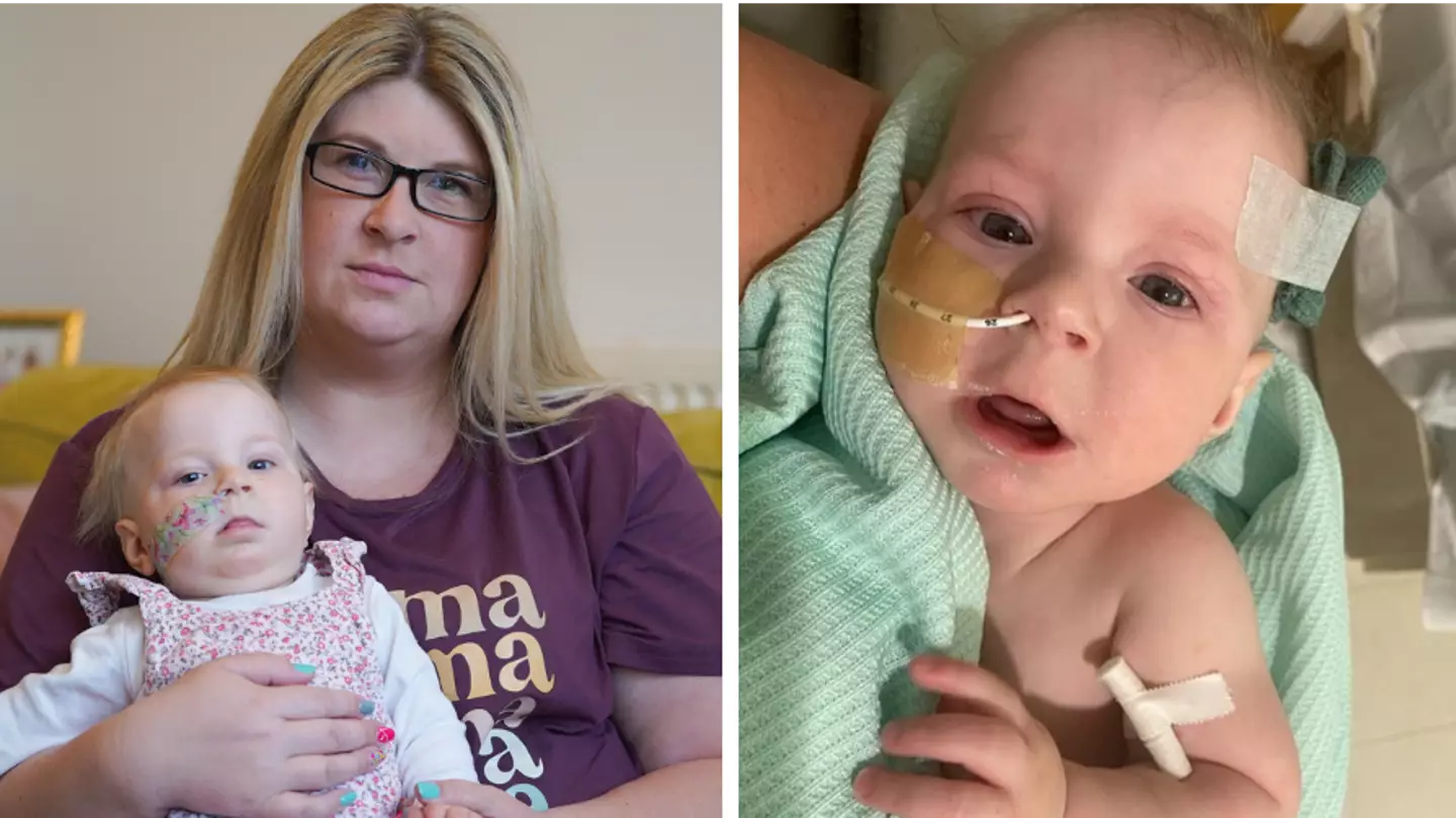 Baby with rare genetic condition has to wait more than five-months for NHS operation