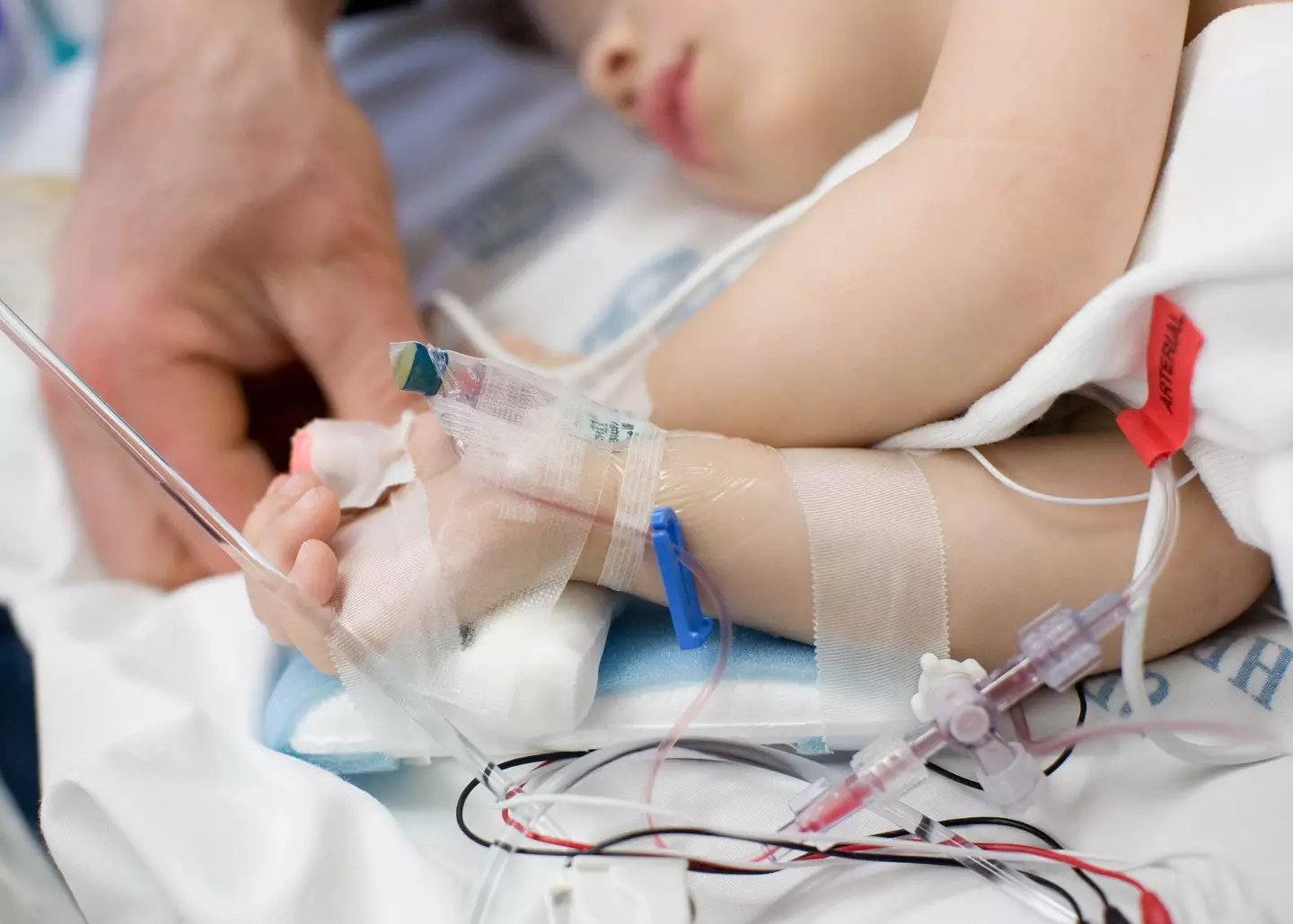 Children exhibiting severe symptoms of sepsis should be taken to A&E.