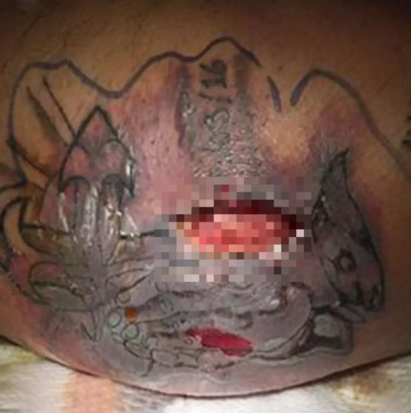 The bacteria came from the sea (BMJ Case Reports)