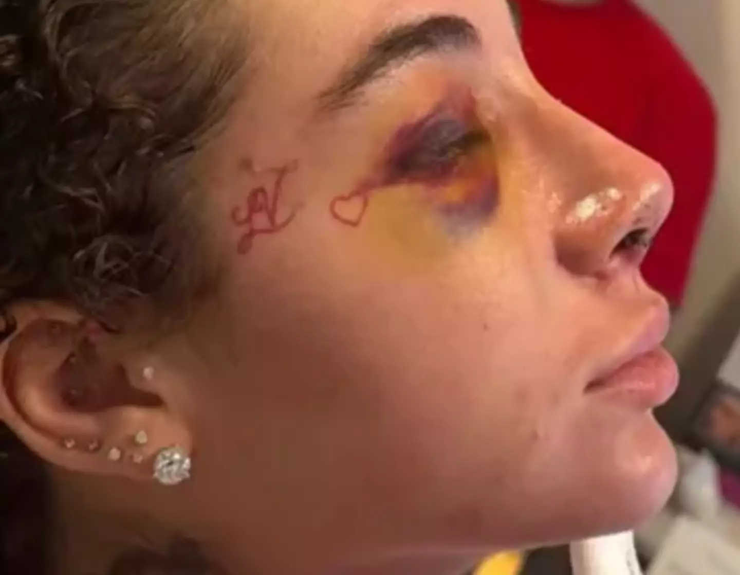 The 21-year-old said nose jobs were 'not for the weak' (Instagram/@bhadbhabie)
