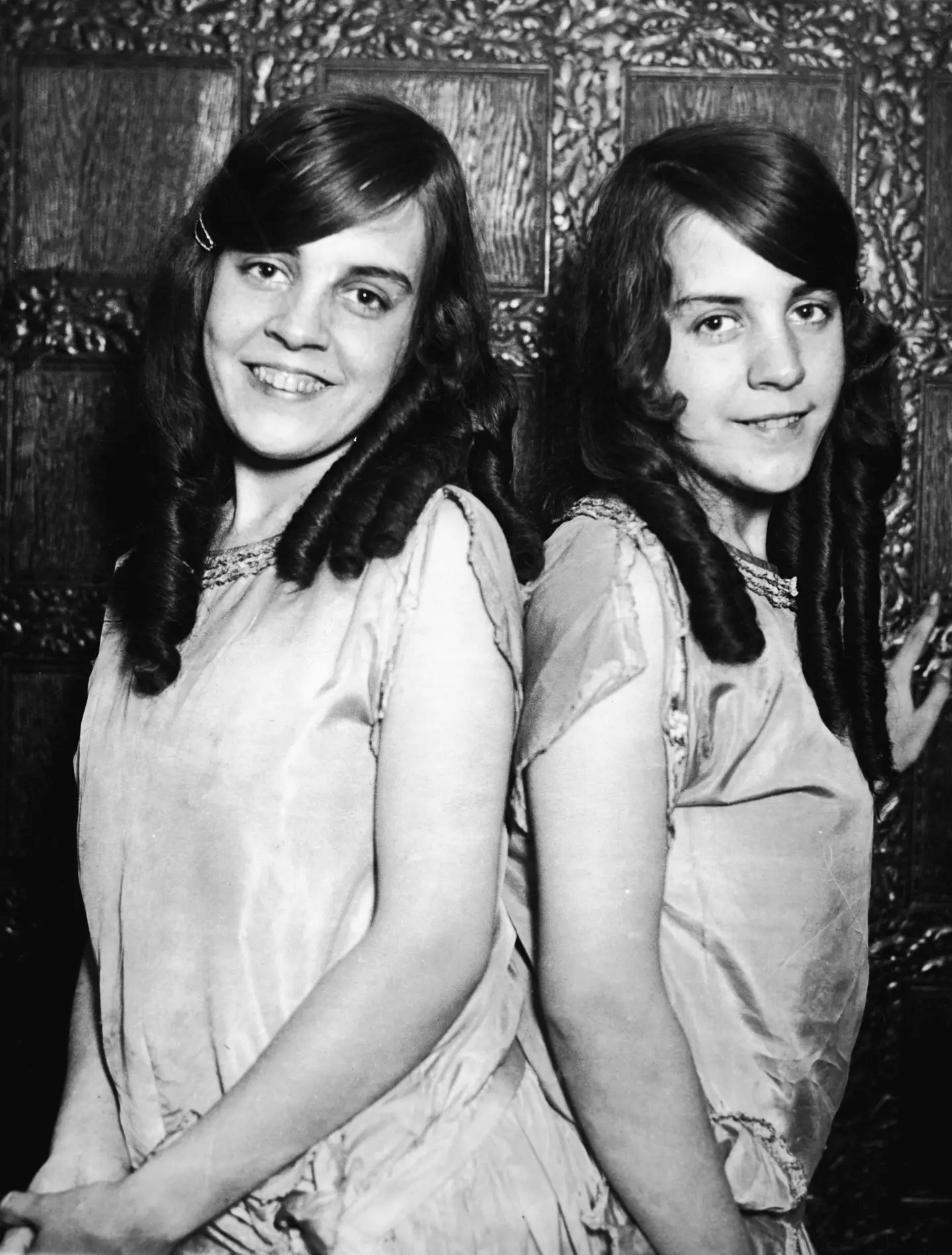 Daisy and Violet Hilton were conjoined at the hip.