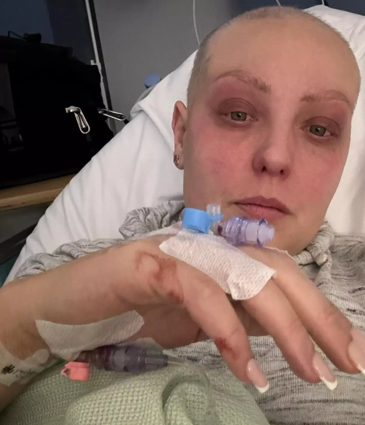 Amy has used her platform to speak openly about her journey with cancer.