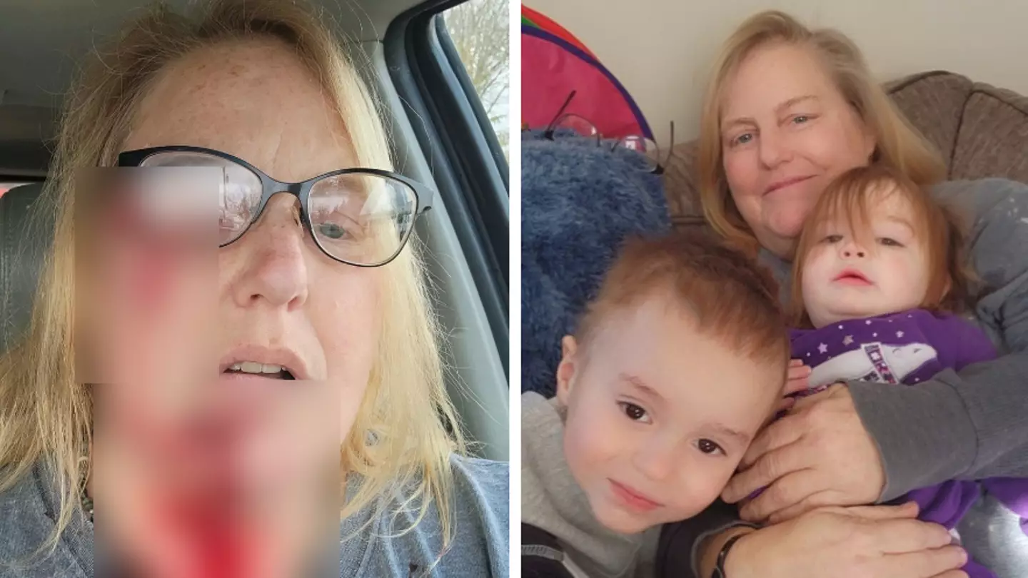 Heroic gran mauled after wrestling pitbull with her bare hands to protect two toddler grandchildren