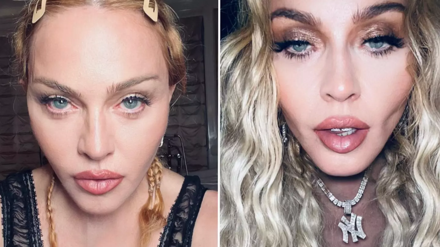 Madonna finally speaks out on ‘near-death’ experience after being in induced coma