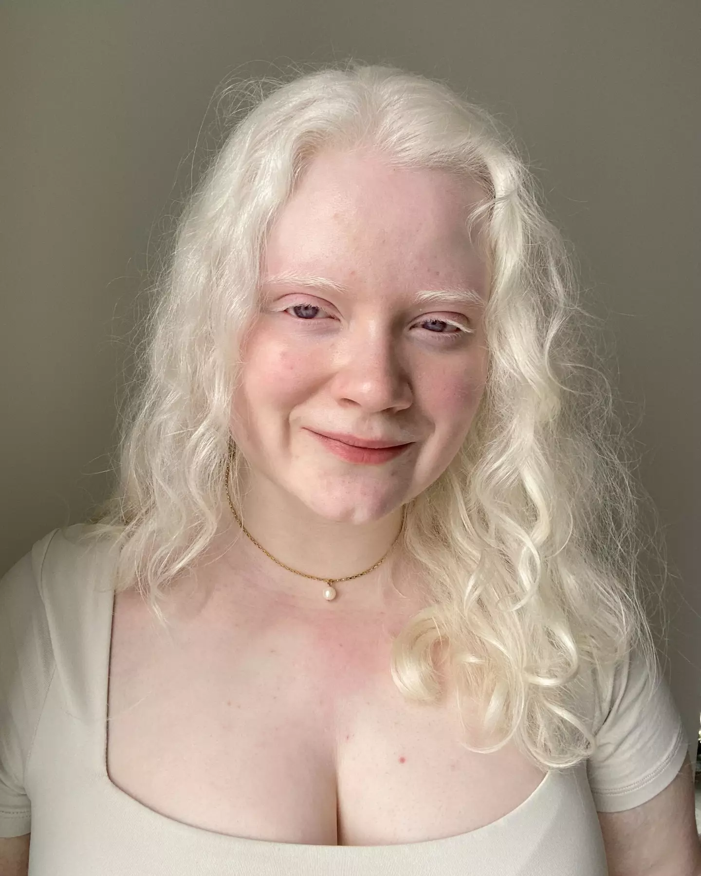 Oceanne Comtois was born with albinism.