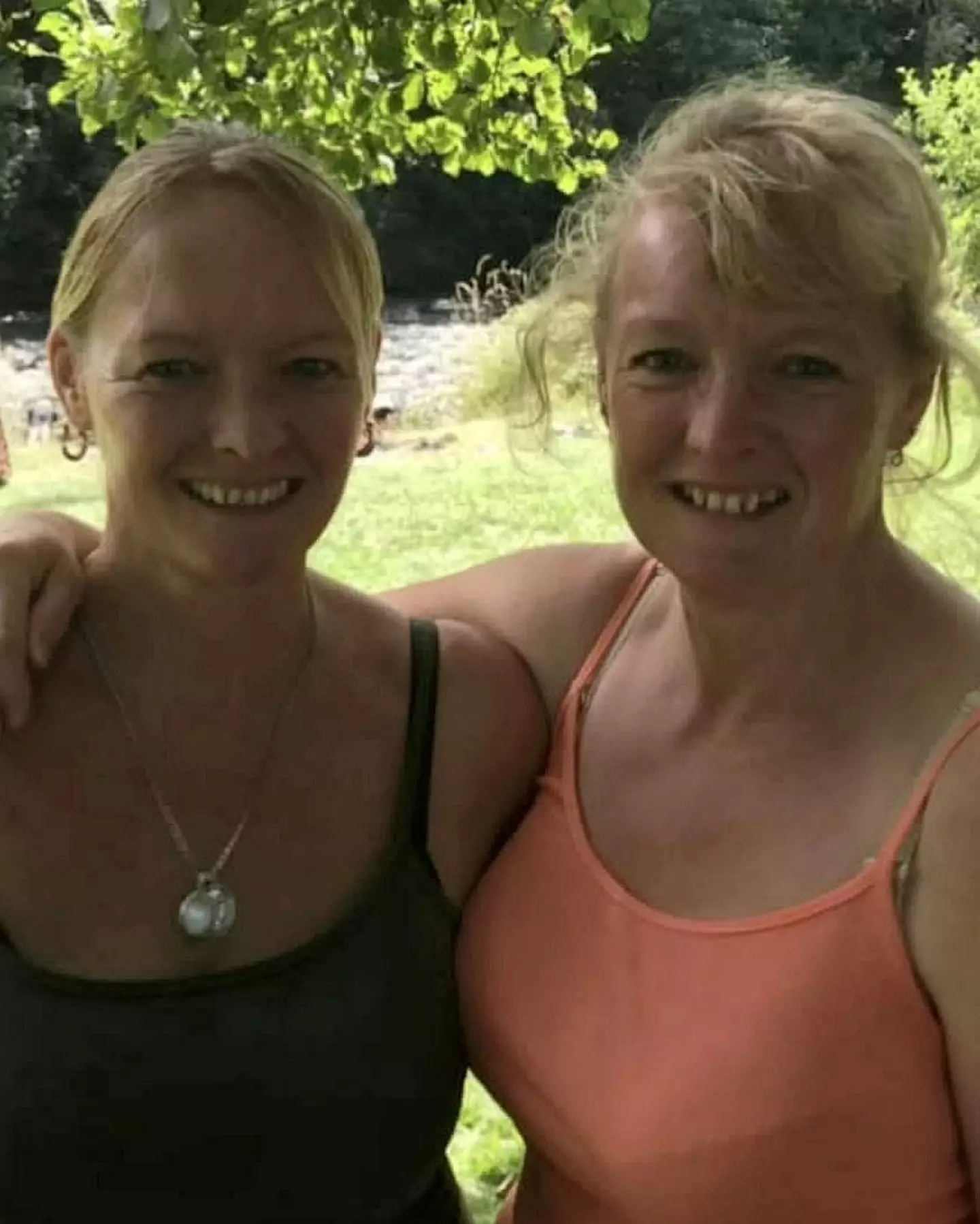 A woman said her painful migraines stopped when her twin sister had her brain tumour removed.