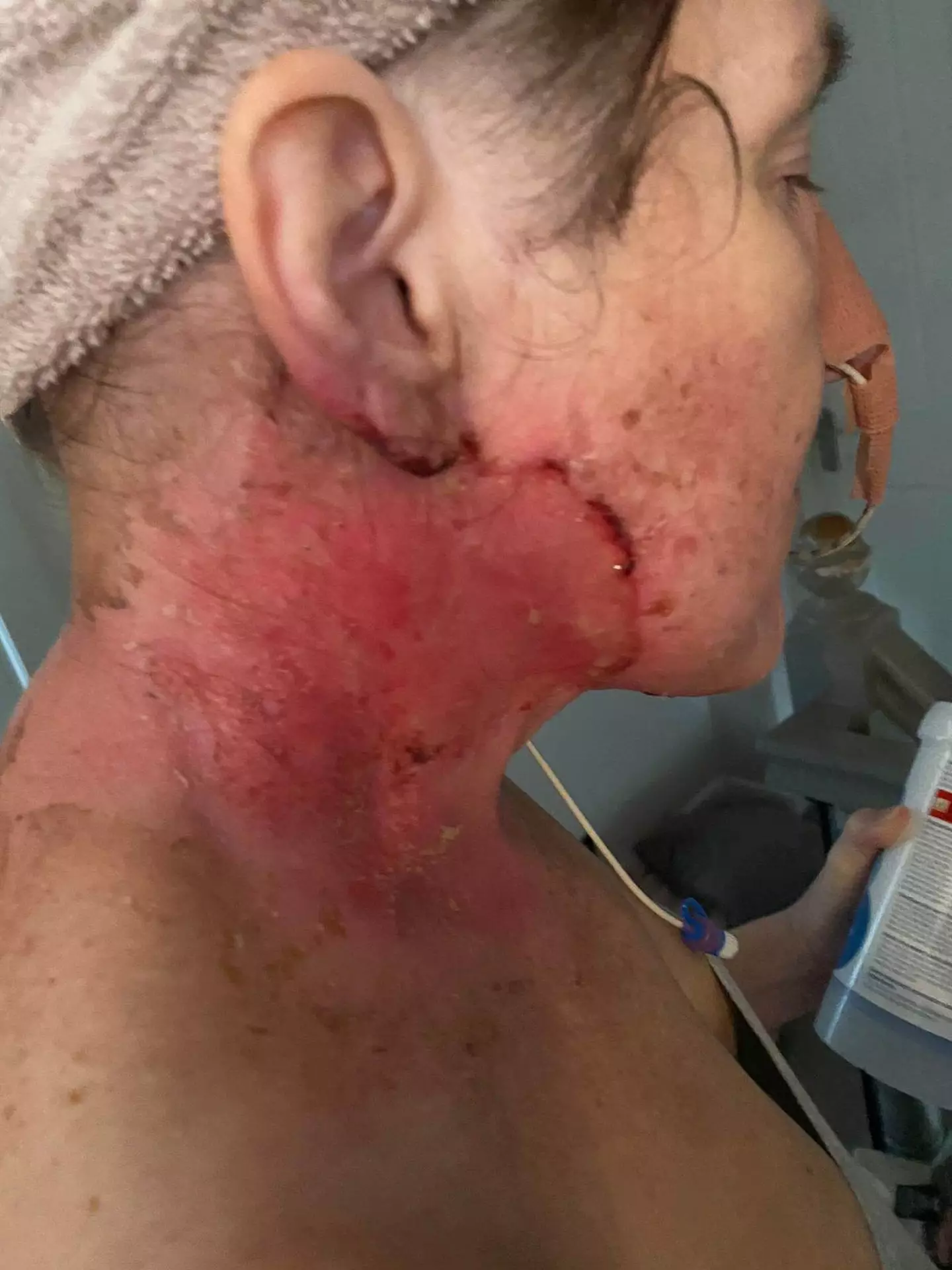 But it turned out to be cancer.