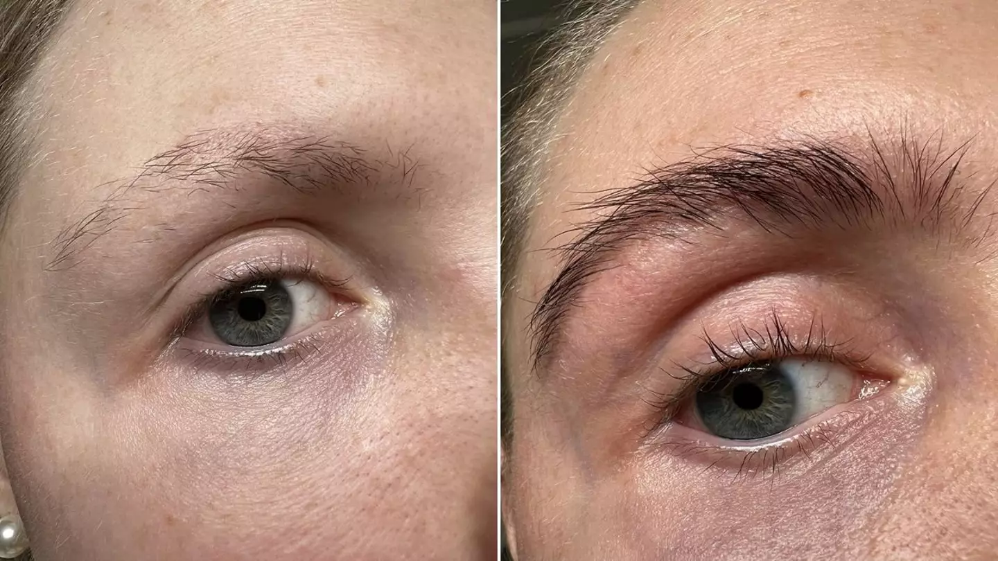 Before and after, Amazon reviews