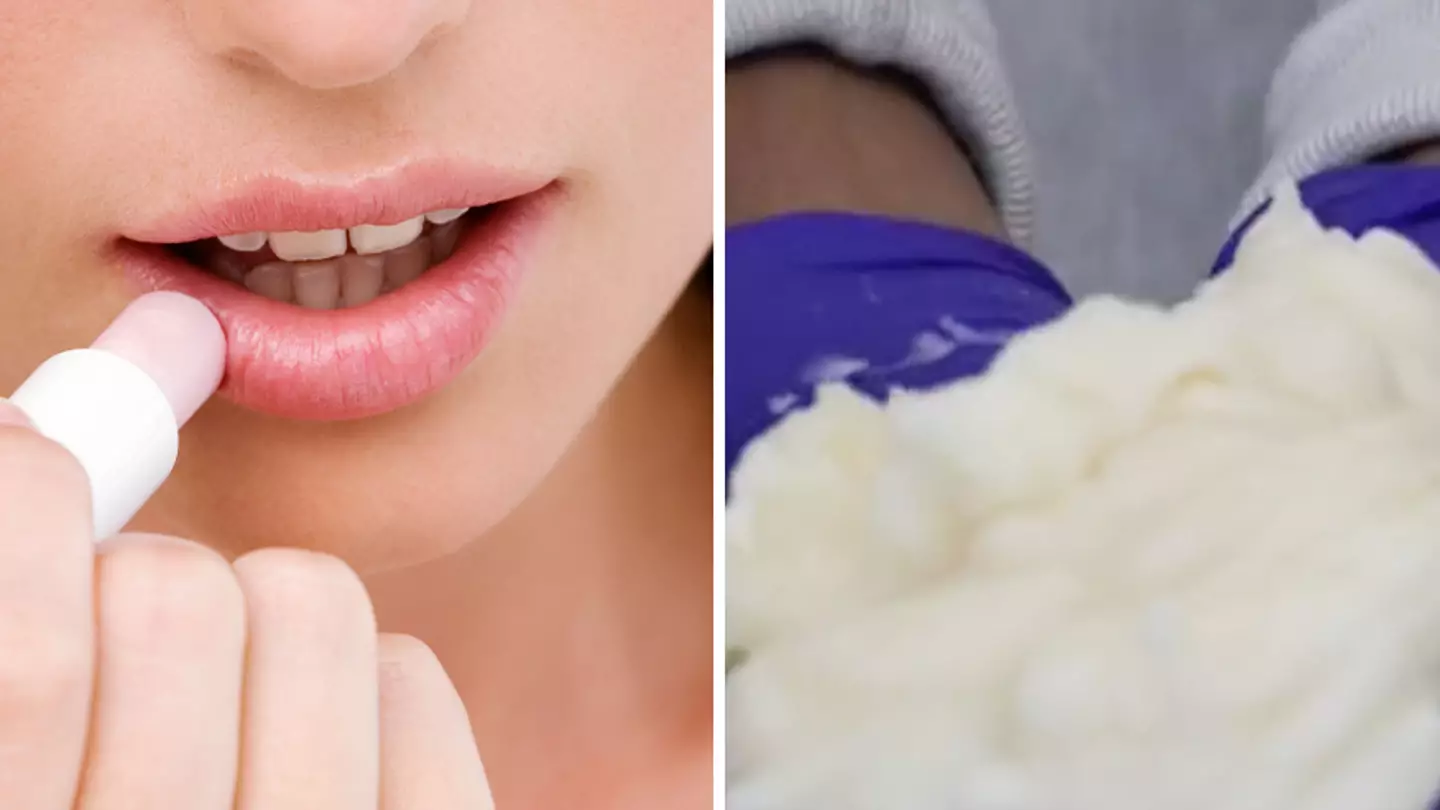 People disgusted after realising how much lip balm you eat in two years