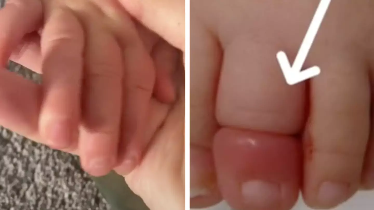 Mum's warning to always check baby's hands and feet if they won't stop crying
