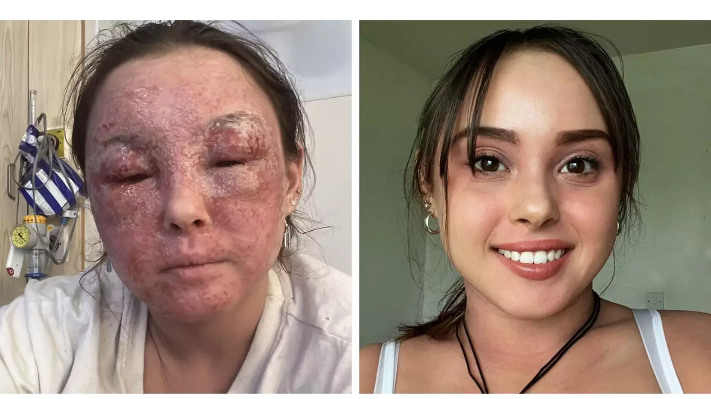 Woman 'too scared to travel' after trip left her skin 'ripped apart'