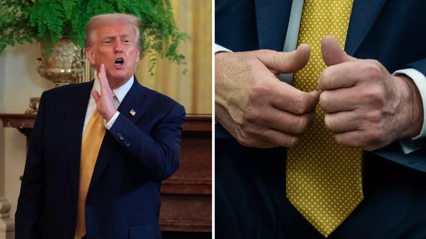Donald Trump’s 'mysterious' bruise appears again after officials explained reason for it