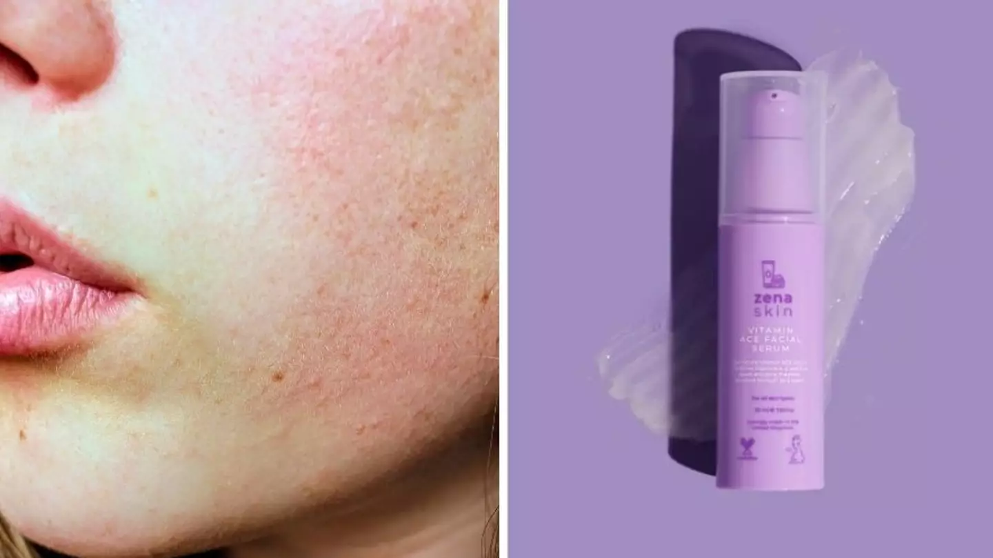 Shoppers Are Calling This £19 Serum For Dry Skin 'Liquid Silk'