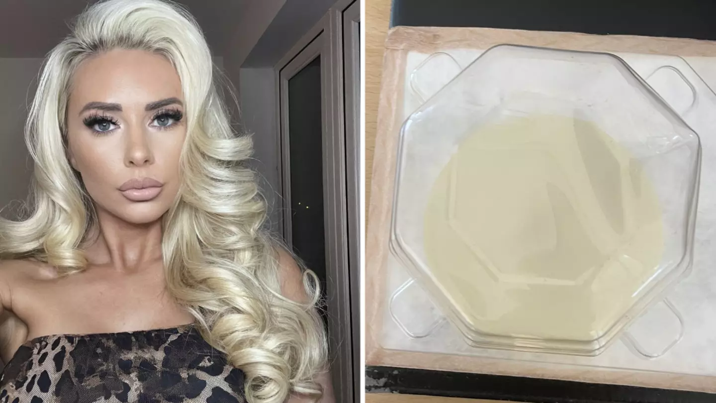 Woman issues warning after boob job uncovered cancer she didn’t know she had