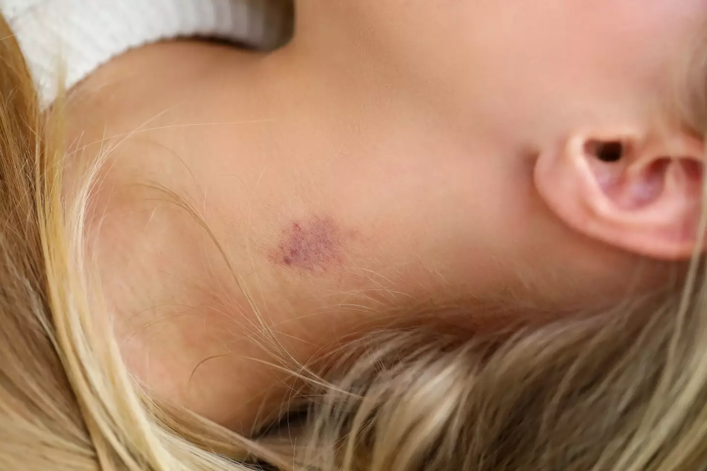 There are rare cases where a hickey could lead to a stroke (Getty Stock Images)