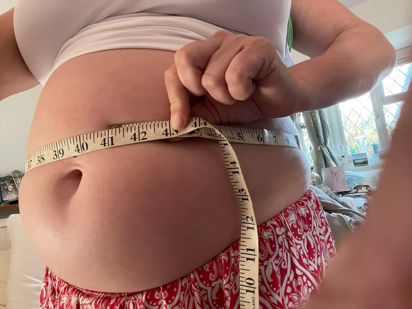 Fibroids left Abigail looking pregnant.