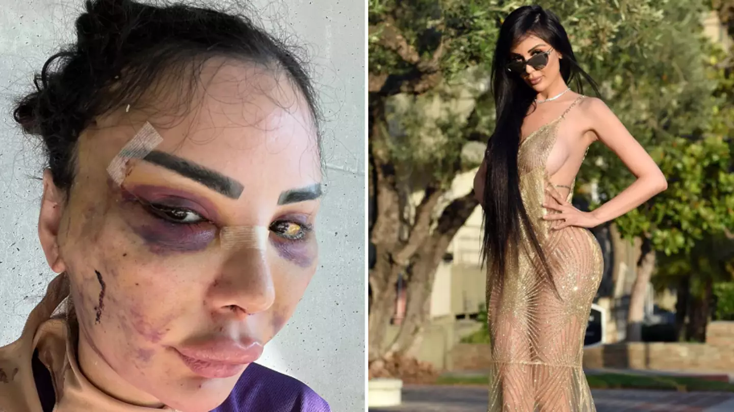 Woman who spent $600k to turn herself into Kim Kardashian is now paying to revert to 'natural' appearance