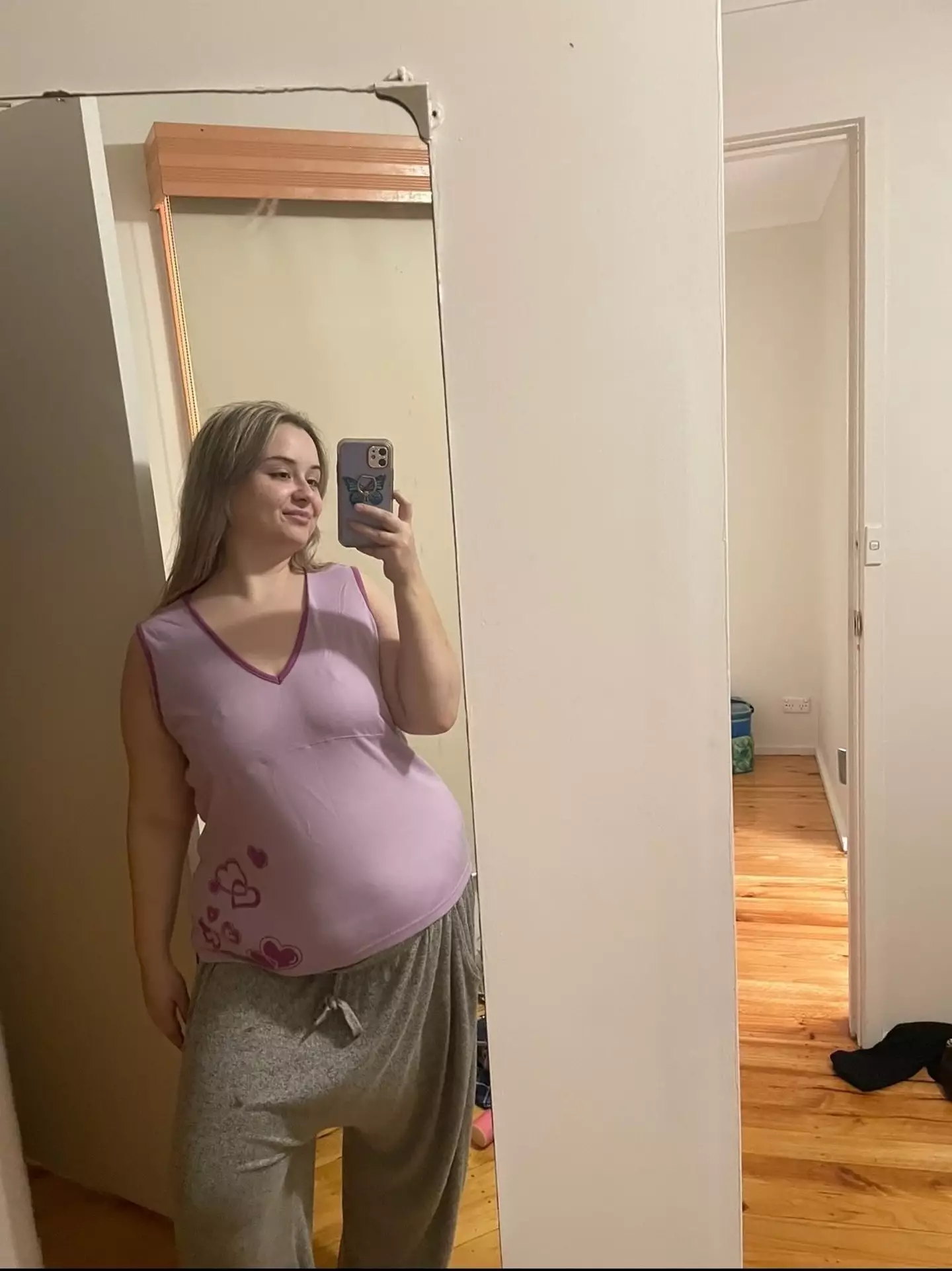 The 25-year-old is happy with the results of her surgery.