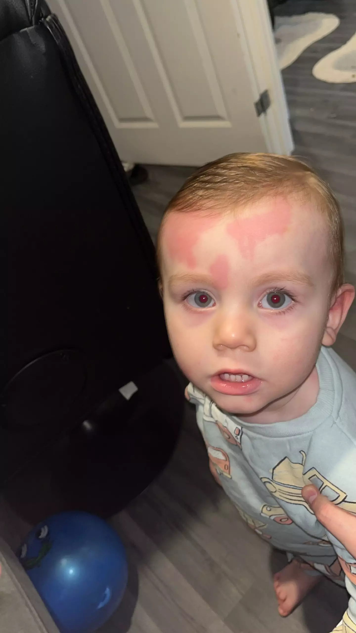 Natalie said little Haisley's welts were 'hot to touch'.