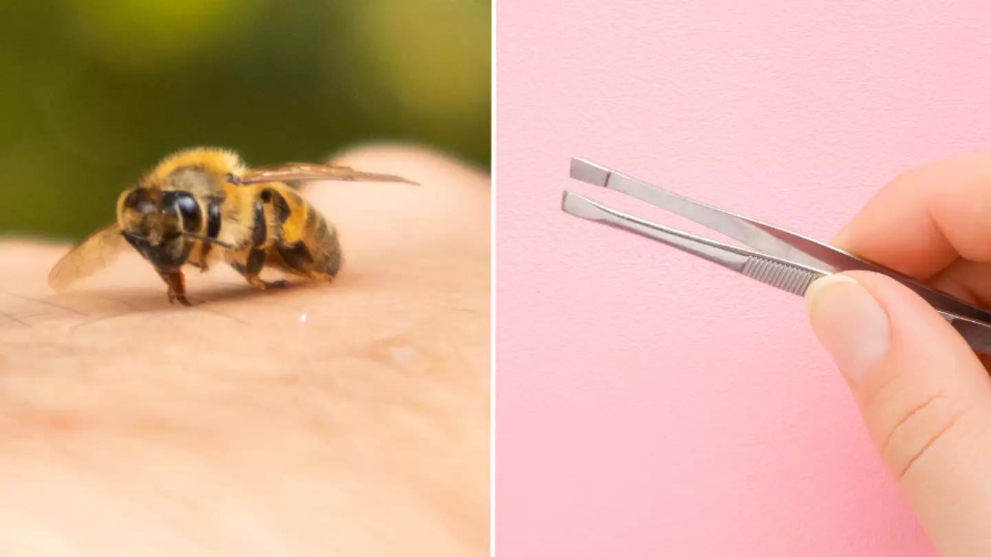 NHS advice on why you should never remove bee or wasp stings with tweezers