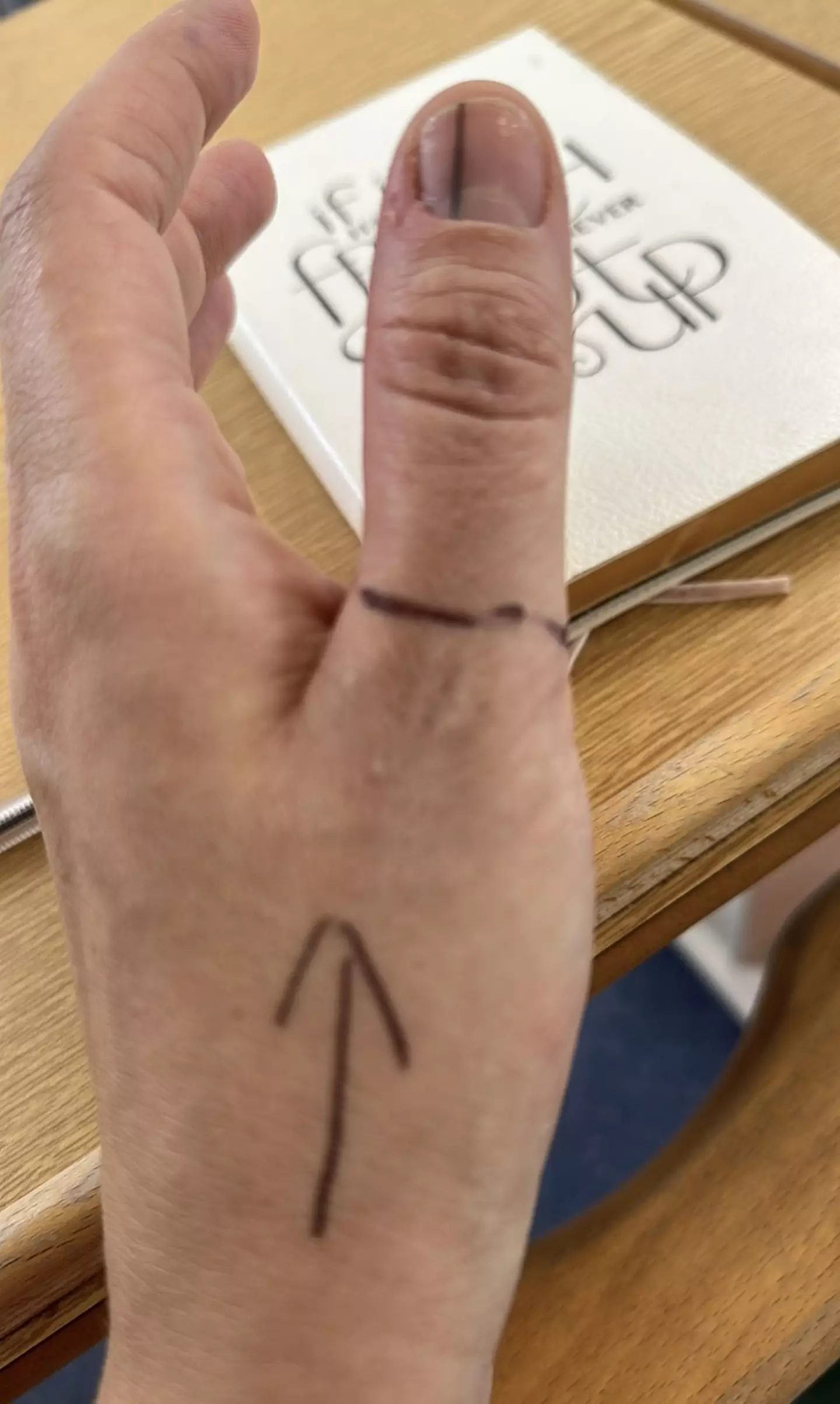 Thompson noticed a black streak under her thumb nail (Kennedy News and Media)