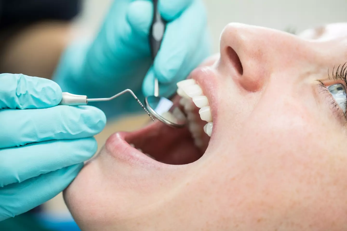 The dentist mapped out several preventative measures to take to avoid the black triangles.