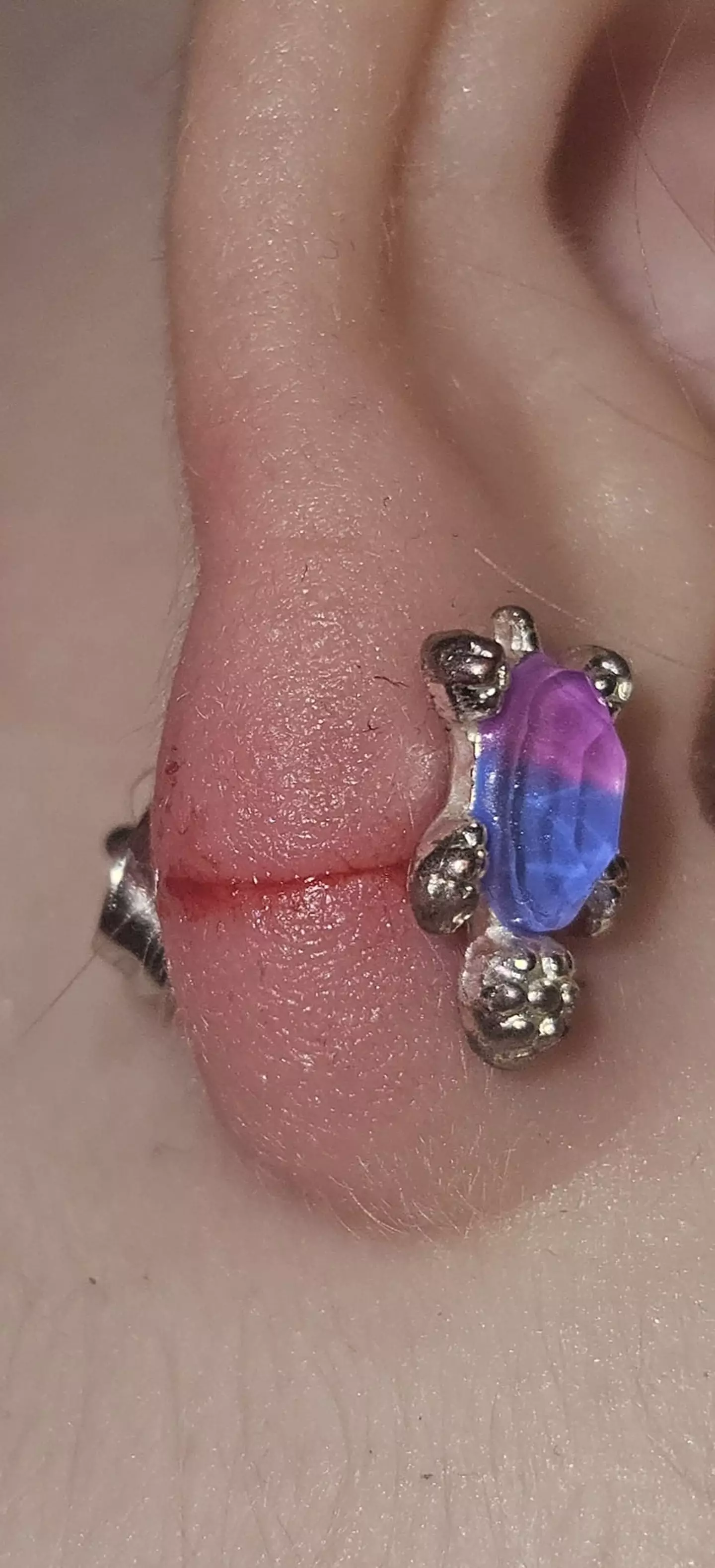 A hair wrapped around the toddler's earring and 'sliced' through her ear.