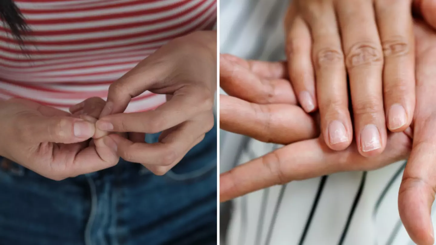 'Early warning signs' of serious health problems can be seen in your nails