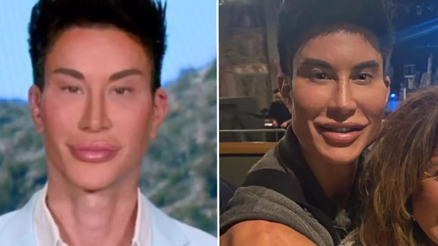'Human Ken Doll' Justin Jedlica explains why he spent over $1 million on 1,000 surgeries