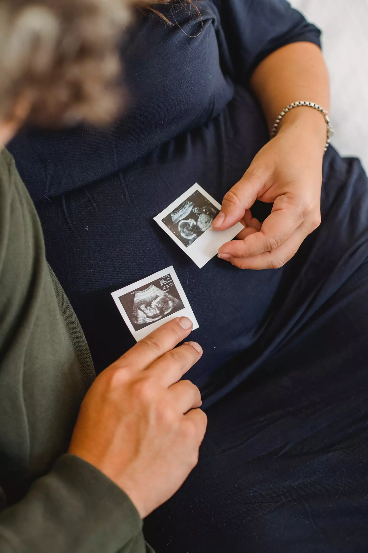 The couple have lost seven babies in total.