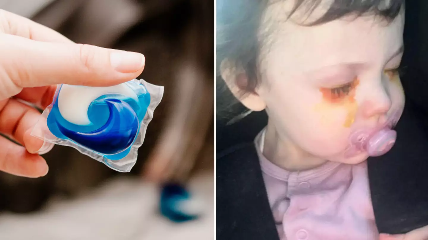 Mum issues urgent warning about laundry pods after one-year-old suffered horrifying third degree burns